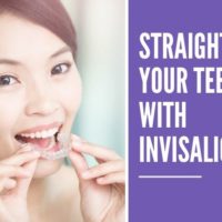 Straighten your teeth with Invisalign.